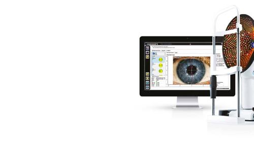 Cassini - True corneal shape analysis aids corrective eye surgeries